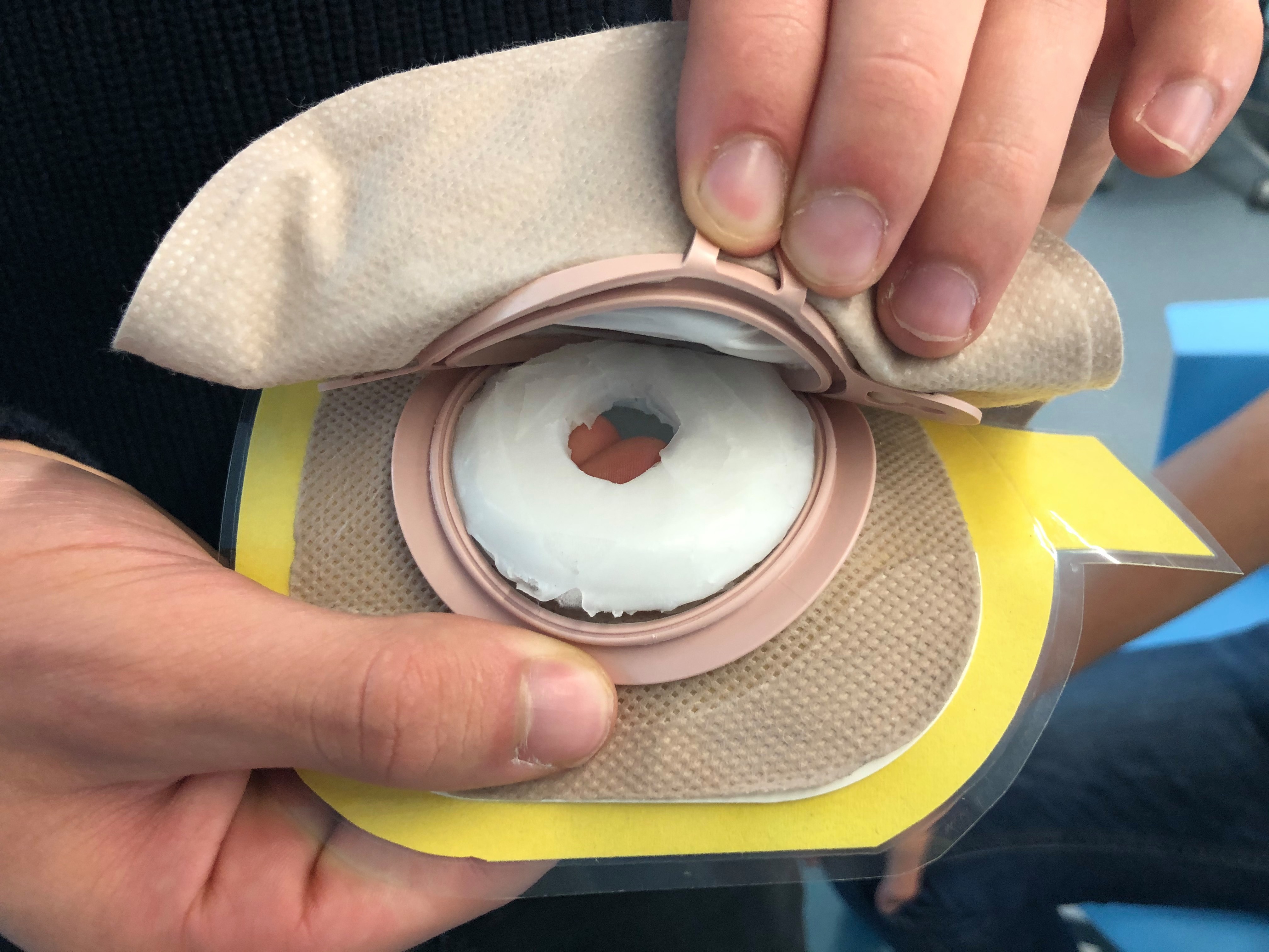 Image of ostomy wafer open